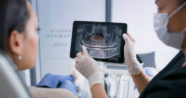 Licensed Teeth Whitening service in Whitefish, MT - Smile Center Dentistry